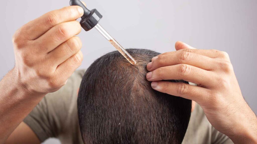 Cómo pueden los hombres dejarse crecer el pelo largo 20 crecer pelo
