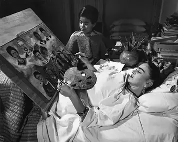 Frida Kahlo: Descubriendo su Nacimiento y Legado 3 Joven Frida Kahlo después del accidente